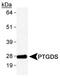 Prostaglandin-H2 D-isomerase antibody, PA1-46022, Invitrogen Antibodies, Western Blot image 