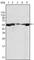 LYN Proto-Oncogene, Src Family Tyrosine Kinase antibody, abx011096, Abbexa, Western Blot image 