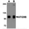 Autophagy Related 9B antibody, MBS150868, MyBioSource, Western Blot image 