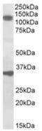 Dixin antibody, AP10048PU-N, Origene, Western Blot image 