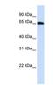 DDB1 And CUL4 Associated Factor 11 antibody, NBP1-57691, Novus Biologicals, Western Blot image 
