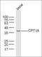Ectonucleotide pyrophosphatase/phosphodiesterase family member 2 antibody, orb13267, Biorbyt, Western Blot image 