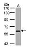 UDP-N-Acetylglucosamine Pyrophosphorylase 1 antibody, orb69739, Biorbyt, Western Blot image 