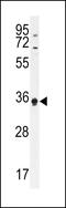 KH Domain Containing 3 Like, Subcortical Maternal Complex Member antibody, 55-725, ProSci, Western Blot image 