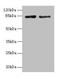 Holliday Junction Recognition Protein antibody, LS-C369776, Lifespan Biosciences, Western Blot image 
