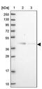 2-Oxoglutarate And Iron Dependent Oxygenase Domain Containing 2 antibody, PA5-59138, Invitrogen Antibodies, Western Blot image 