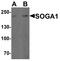 Suppressor Of Glucose, Autophagy Associated 1 antibody, A13046, Boster Biological Technology, Western Blot image 