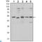 SMAD Family Member 5 antibody, LS-C812774, Lifespan Biosciences, Western Blot image 