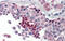 DAX1 antibody, ARP31632_P050, Aviva Systems Biology, Immunohistochemistry paraffin image 