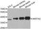 Aldo-Keto Reductase Family 7 Member A2 antibody, TA327011, Origene, Western Blot image 
