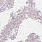 Protein C19orf84  antibody, PA5-64357, Invitrogen Antibodies, Immunohistochemistry paraffin image 