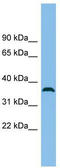 Chromosome 18 Open Reading Frame 25 antibody, TA339949, Origene, Western Blot image 