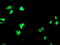 Peroxisome Proliferator Activated Receptor Alpha antibody, TA503543, Origene, Immunofluorescence image 