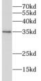 Rhomboid Like 2 antibody, FNab07278, FineTest, Western Blot image 