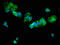 Tyrosine Aminotransferase antibody, LS-C671310, Lifespan Biosciences, Immunofluorescence image 