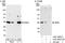 Survival Of Motor Neuron 2, Centromeric antibody, A301-863A, Bethyl Labs, Western Blot image 