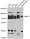 ATP Binding Cassette Subfamily F Member 2 antibody, 19-352, ProSci, Western Blot image 