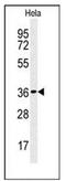 CTD small phosphatase-like protein antibody, AP51119PU-N, Origene, Western Blot image 
