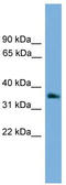 G Protein Subunit Beta 4 antibody, TA344722, Origene, Western Blot image 
