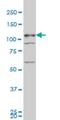 TBC1 Domain Family Member 8 antibody, H00011138-M02, Novus Biologicals, Western Blot image 