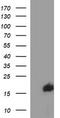 SIVA1 Apoptosis Inducing Factor antibody, CF506830, Origene, Western Blot image 