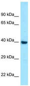 Melanocortin 1 Receptor antibody, TA343283, Origene, Western Blot image 