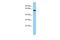 TELO2 Interacting Protein 2 antibody, A12943, Boster Biological Technology, Western Blot image 