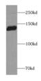 Brevican antibody, FNab00954, FineTest, Western Blot image 