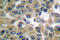 Human Chorionic gonadotrophin antibody, LS-C176054, Lifespan Biosciences, Immunohistochemistry frozen image 