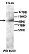 Ciliary neurotrophic factor receptor subunit alpha antibody, orb76973, Biorbyt, Western Blot image 