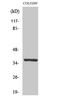 Olfactory Receptor Family 52 Subfamily E Member 5 antibody, A18783, Boster Biological Technology, Western Blot image 
