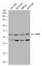 Cerebellar Degeneration Related Protein 2 antibody, GTX129122, GeneTex, Western Blot image 