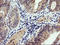 Phosphatidylinositol-4,5-bisphosphate 3-kinase catalytic subunit gamma isoform antibody, LS-C174230, Lifespan Biosciences, Immunohistochemistry frozen image 