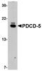 Programmed Cell Death 5 antibody, NBP1-76988, Novus Biologicals, Western Blot image 