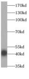 ELL-associated factor 1 antibody, FNab02608, FineTest, Western Blot image 