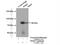 Phosphofructokinase, Platelet antibody, 13389-1-AP, Proteintech Group, Immunoprecipitation image 