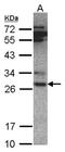 Proteasome 20S alpha 6 antibody, orb74179, Biorbyt, Western Blot image 