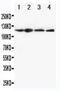 NLR Family Pyrin Domain Containing 3 antibody, PA5-79740, Invitrogen Antibodies, Western Blot image 