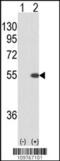 Serine/Threonine Kinase 40 antibody, 63-749, ProSci, Western Blot image 