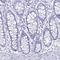 Leucine Zipper Protein 4 antibody, PA5-62528, Invitrogen Antibodies, Immunohistochemistry paraffin image 