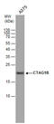 Cancer/testis antigen 1 antibody, GTX100503, GeneTex, Western Blot image 