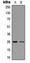 Fibroblast Growth Factor 23 antibody, MBS8222626, MyBioSource, Western Blot image 