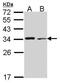 Tropomyosin 4 antibody, PA5-30194, Invitrogen Antibodies, Western Blot image 