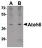 Atonal BHLH Transcription Factor 8 antibody, PA5-20710, Invitrogen Antibodies, Western Blot image 