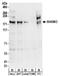 SH3 and multiple ankyrin repeat domains protein 3 antibody, NBP2-32161, Novus Biologicals, Western Blot image 