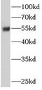 Endoplasmic Reticulum Oxidoreductase 1 Beta antibody, FNab02854, FineTest, Western Blot image 