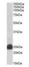 Glutathione S-Transferase Alpha 5 antibody, orb22558, Biorbyt, Western Blot image 