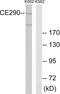 Centrosomal protein of 290 kDa antibody, PA5-39088, Invitrogen Antibodies, Western Blot image 