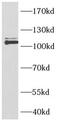 Nuclear Receptor Corepressor 1 antibody, FNab10056, FineTest, Western Blot image 