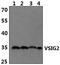 V-Set And Immunoglobulin Domain Containing 2 antibody, PA5-75951, Invitrogen Antibodies, Western Blot image 